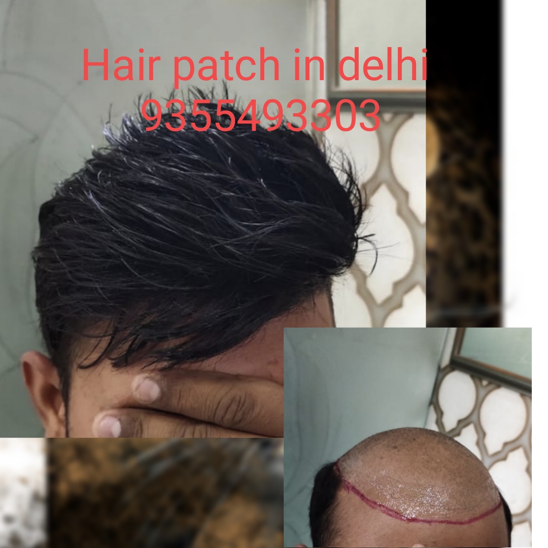 Hair patch for men