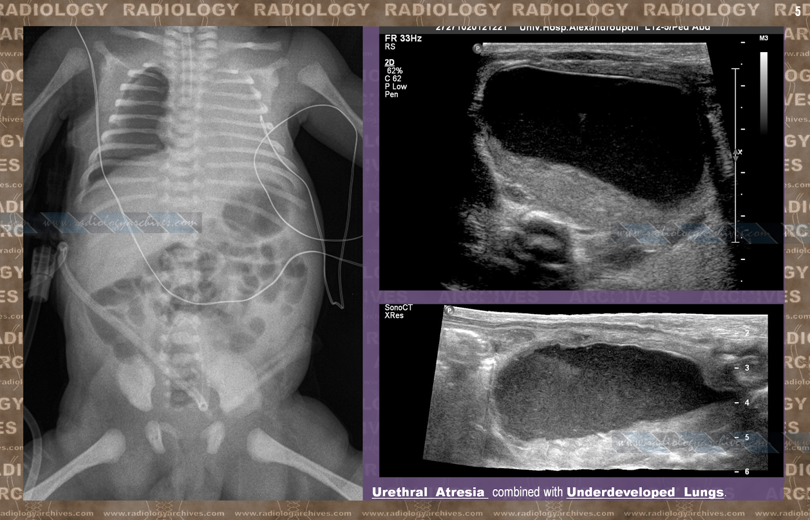 Radiology Archives: Rare & Unusual Pediatric Conditions ...