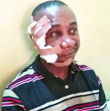 Catholic Priest Shot By Fulani Herdsmen Catholic Priest Shot By Fulani Herdsmen