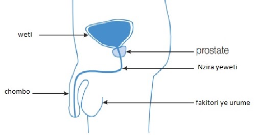 prostatita datorata pantalonilor