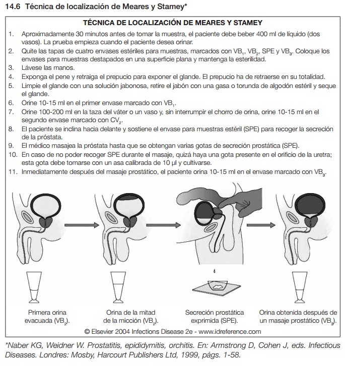 prueba de orina para el diagnóstico de prostatitis prueba de orina para el diagnóstico de prostatitis