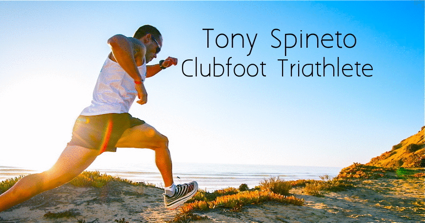 Tony Spineto Clubfoot Athlete