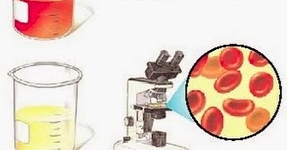 NATURAL TIPS FOR HEMATURIA (BLOOD IN URINE) - Natural Fitness Tips