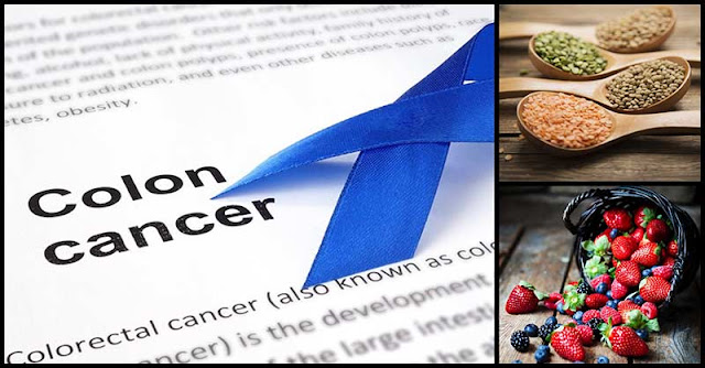 what foods reduce the risk of colon cancer