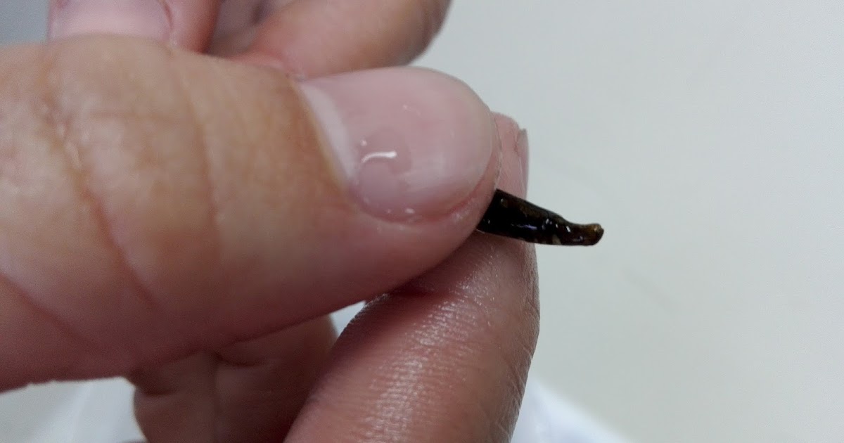 PROYECTO HIPPOPARQUES Nerophis lumbriciformis Localizados en la Ría