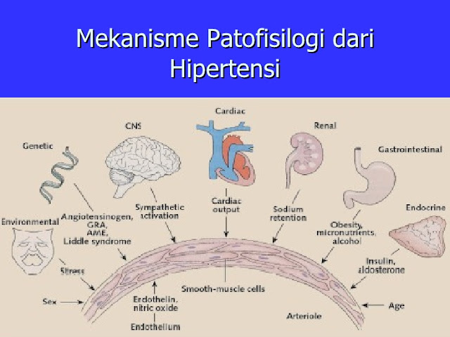 Patofisiologi Hipertensi, Proses Perjalanan Penyakit Hipertensi yang Diacuhkan Banyak Orang