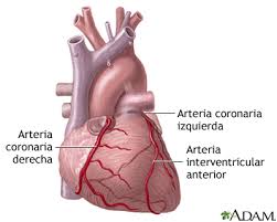 cardiopatia coronaria