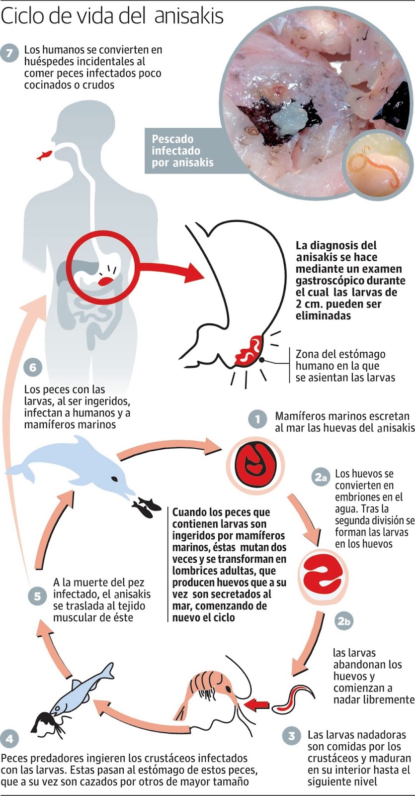 anisakis adulto