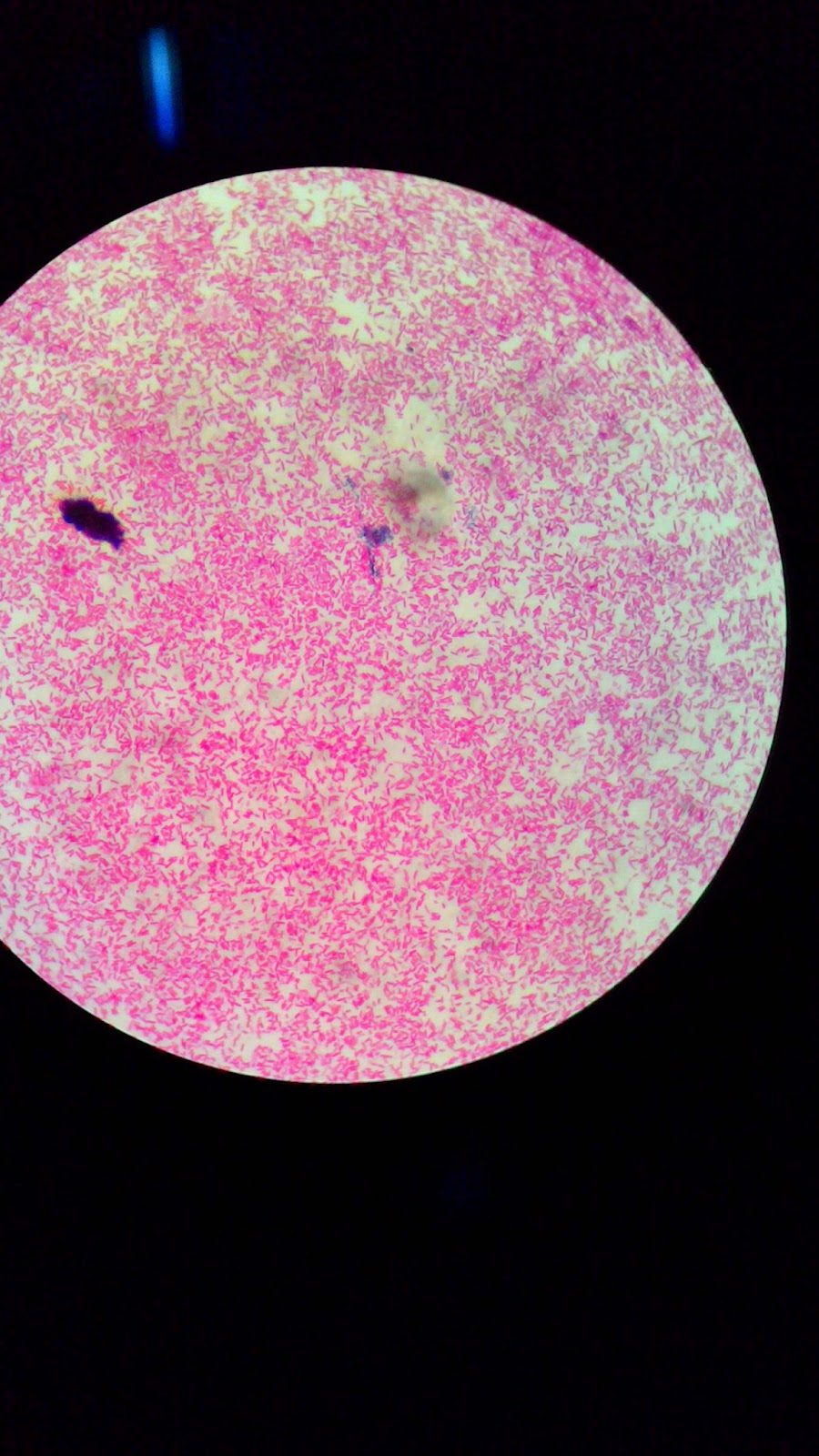 Pewarnaan Gram | Mutia Rahmatika