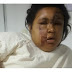 Trujillo: Mujer es golpeada por su conviviente