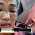 Cây gậy phản động và cái kéo thù địch!