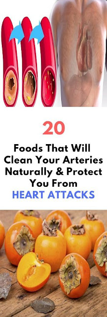 20 Foods That Will Clean Your Arteries Naturally And Protect You From Heart Attacks