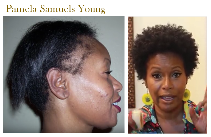 Naturally Thicking Hair Products Naturally Thicking Hair Products
