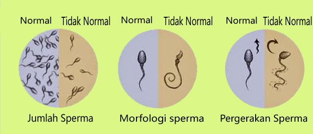 Sperma bukan saja harus ada, tapi juga harus memenuhi kriteria "air ma...