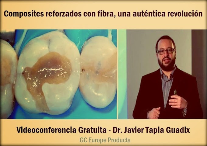 COMPOSITES reforzados con fibra, una auténtica revolución - Videoconferencia del Dr. Javier Tapia Guadix