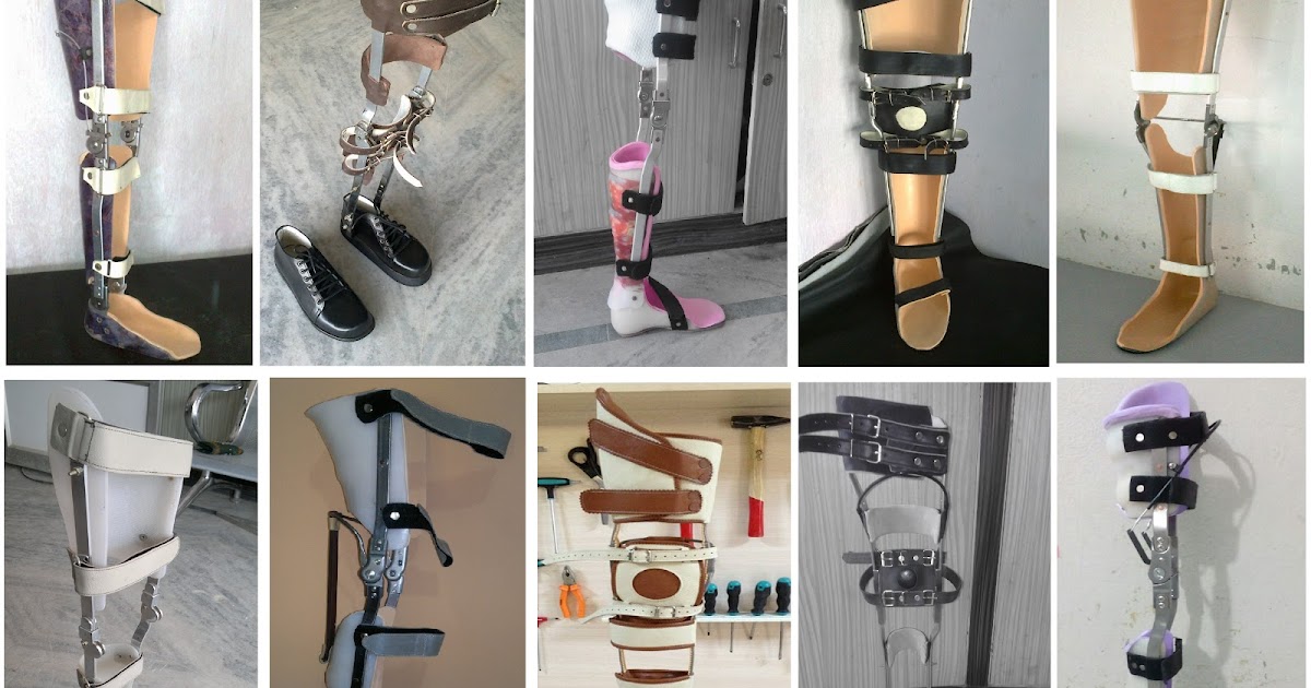 Leg Braces for Paraplegic (SCI)
