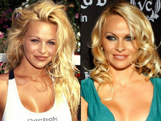 Pamela Anderson Antes y Despues