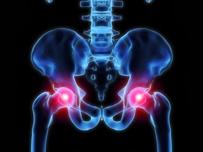 ICD 9 Code For Hip Pain