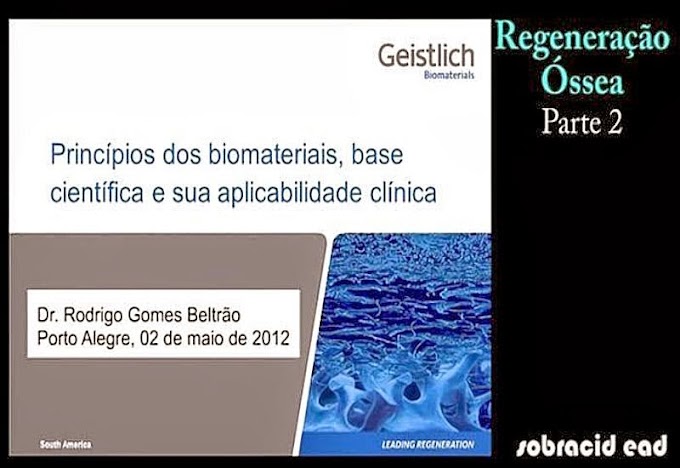 IMPLANTODONTIA: Regeneração Óssea - Geistlich Biomateriais (Video 2)