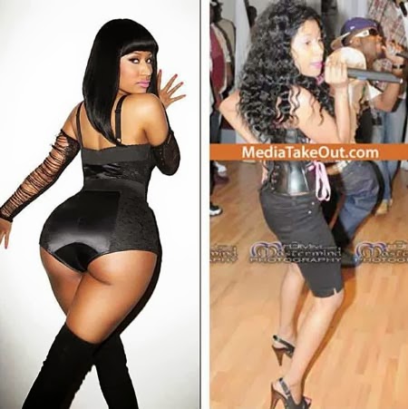 Nicki-Minaj_before-and-after-plastic-sur