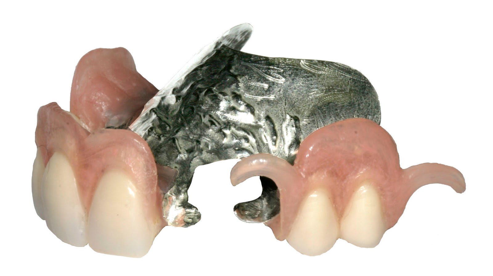 News Room ROE Dental Laboratory Valplast Adjustment