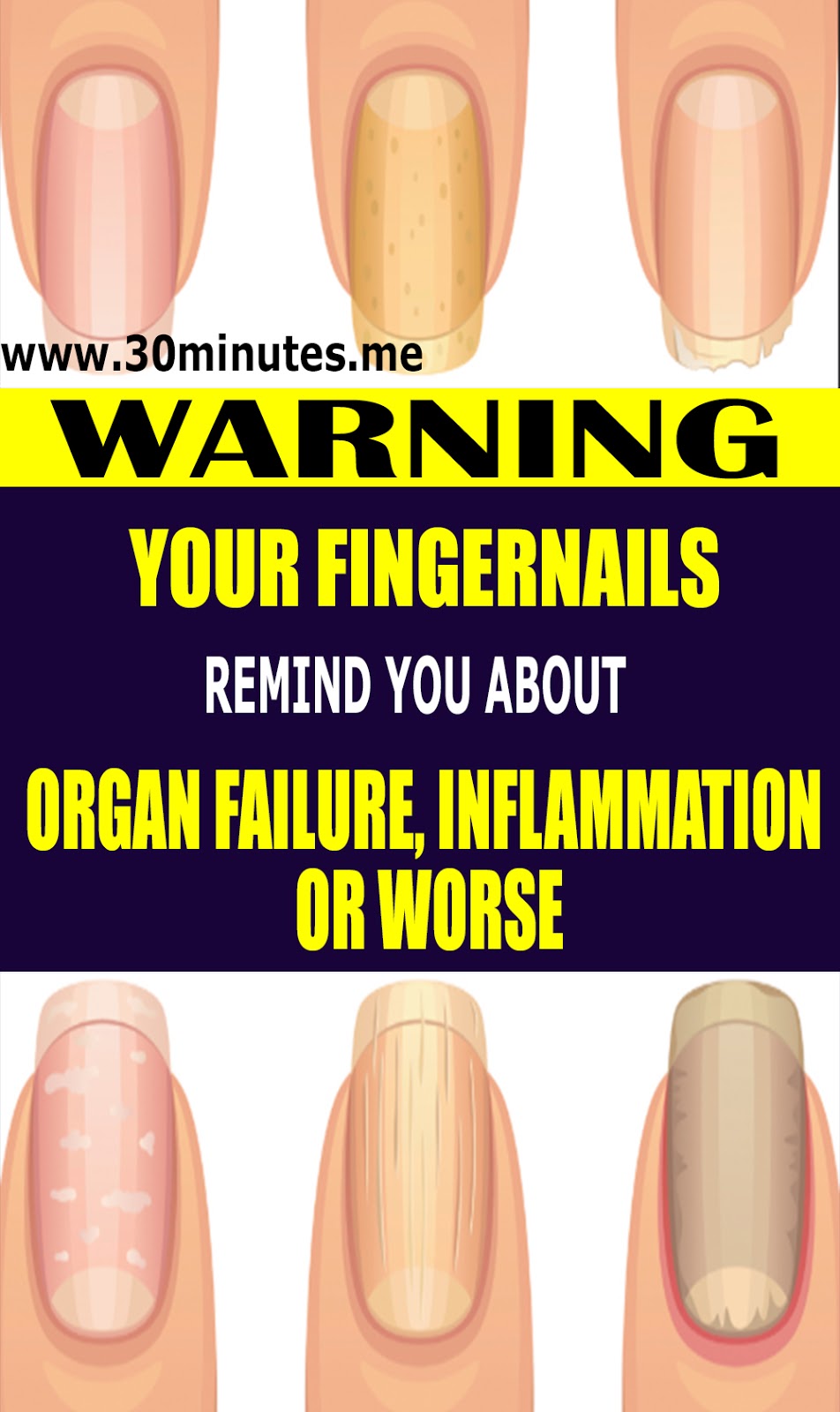 This Is What Your Fingernails Are Warning You About Organ Failure