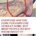 Everyone Has The Cure For Varicose Veins At Home, But Many People Do Not Know About It!
