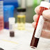 Cientistas relatam segundo caso de cura do HIV após transplante