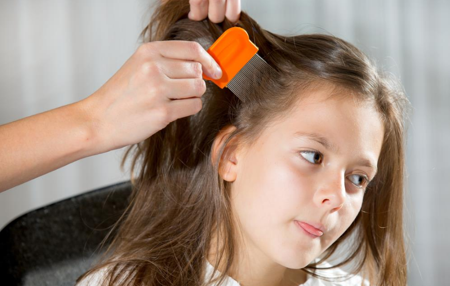 How to tell if your child has head lice News Grooque