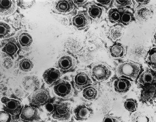 Herpes simplex virus | Medical silver