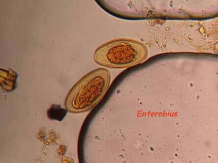 enterobius vermicularis reproducao