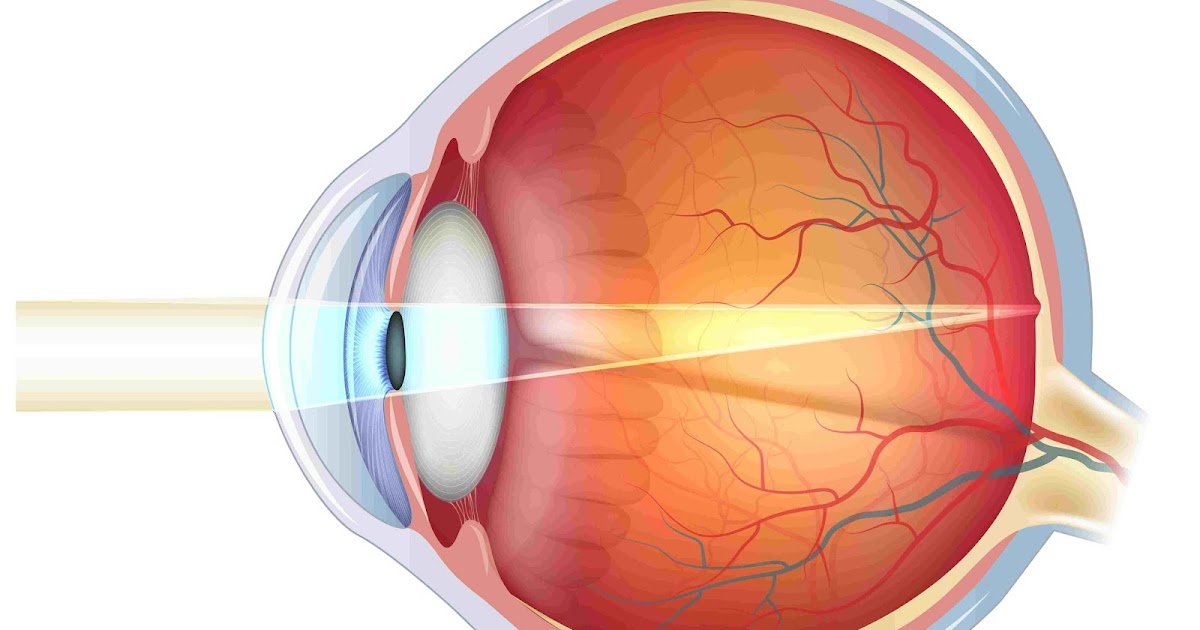 Аккомодация сетчатки. Пресбиопия глаз. Ретинопексия глаз периферическая лазерная. Посттромботическая ретинопатия.