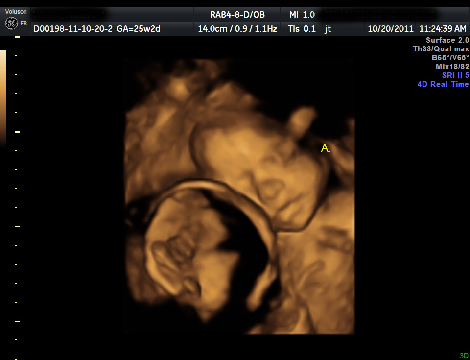 A baby for you My surprise for the daddies