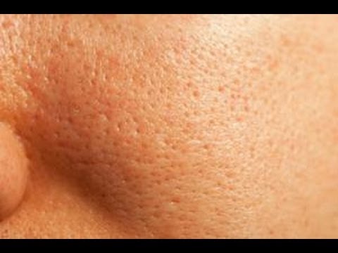 How To Unclog Pores On Face Naturally How To Unclog Pores On Face Naturally