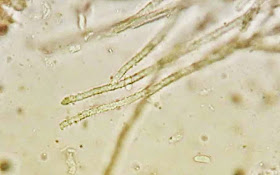 Spores and encrusted hairs of Calathella eruciformis