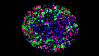 Resultado de imagen para celulas beta de los islotes de langerhans harvard stem cell insitute