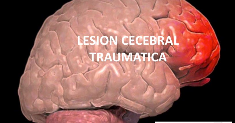 Hinchazón cerebral después de un trauma