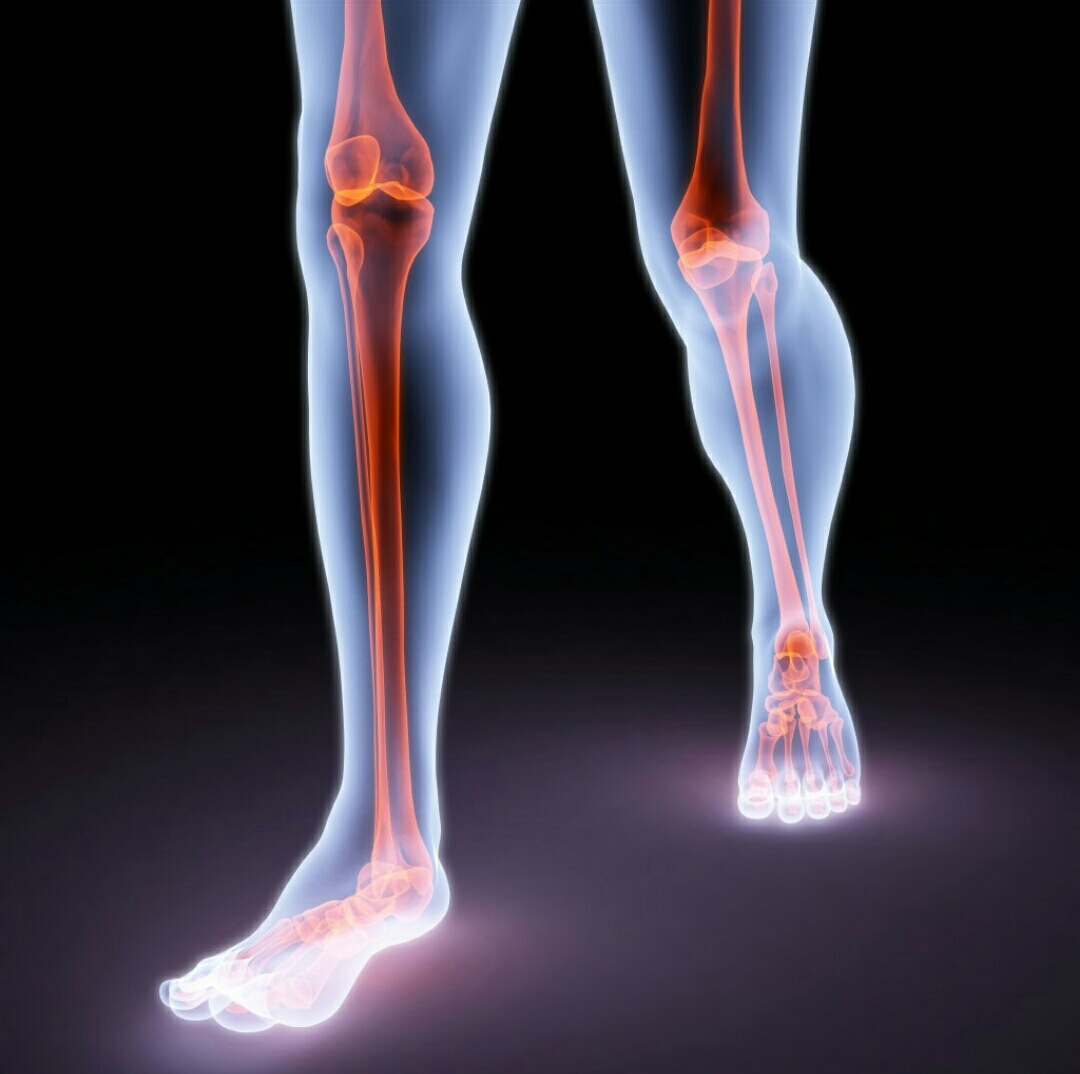 Рак кости ноги. Онкология костей голени. Заболевание костей ног.