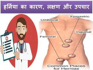 hernia-causes-symptoms-treatment-in-hindi