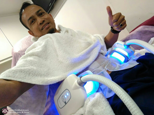 Khir Khalid - Rawatan Buang Lemak Cryo-Lipolysis Dengan Zimmer Z Lipo dan Z WavePro Khir Khalid - Rawatan Buang Lemak Cryo-Lipolysis Dengan Zimmer Z Lipo dan Z WavePro
