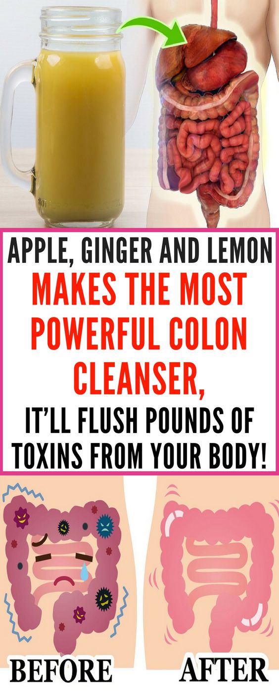 Apple, Ginger And Lemon Makes the Most Powerful Colon Cleanser, It’ll