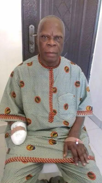 kidnappers amputates retired mobil staff