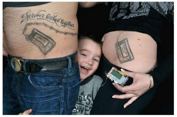 26 Moments That Will Restore Your Faith In Humanity Again - His parents tattooed insulin pumps on their bellies so their diabetic son wouldn’t feel “different”