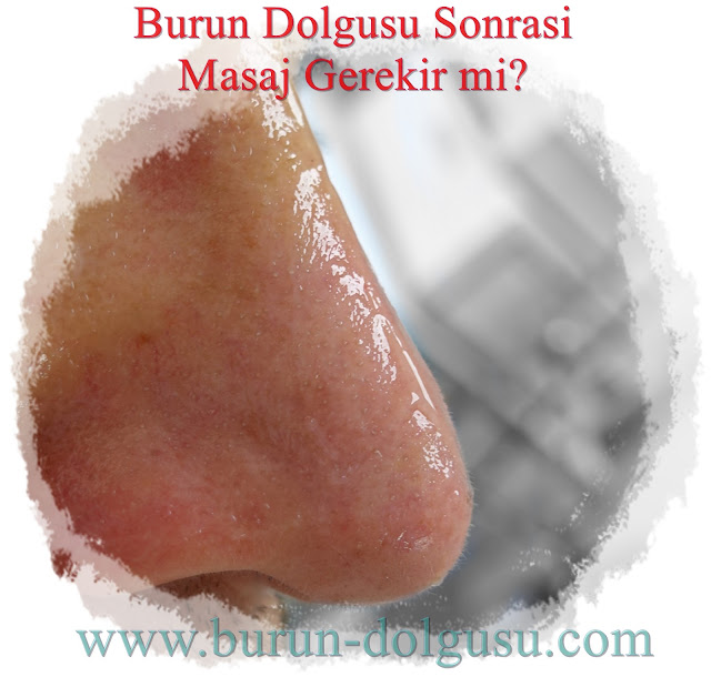 Burun dolgusu sonrası masaj gerekir mi? - Dolgu sonrası buru masajı gerekir mi? - Dolgu ile burun estetiği sonrası masaj gerekir mi? - Burun dolgusu sonrası masaj nasıl yapılır?