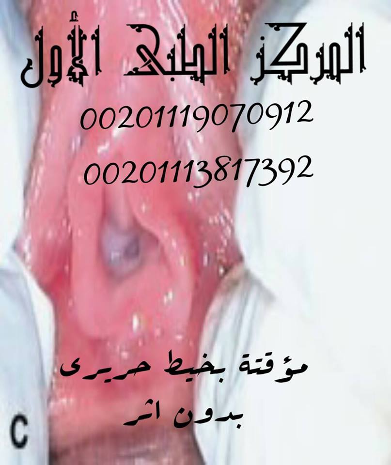 عمليات ترقيع غشاء البكارة المركز الطبى الاول