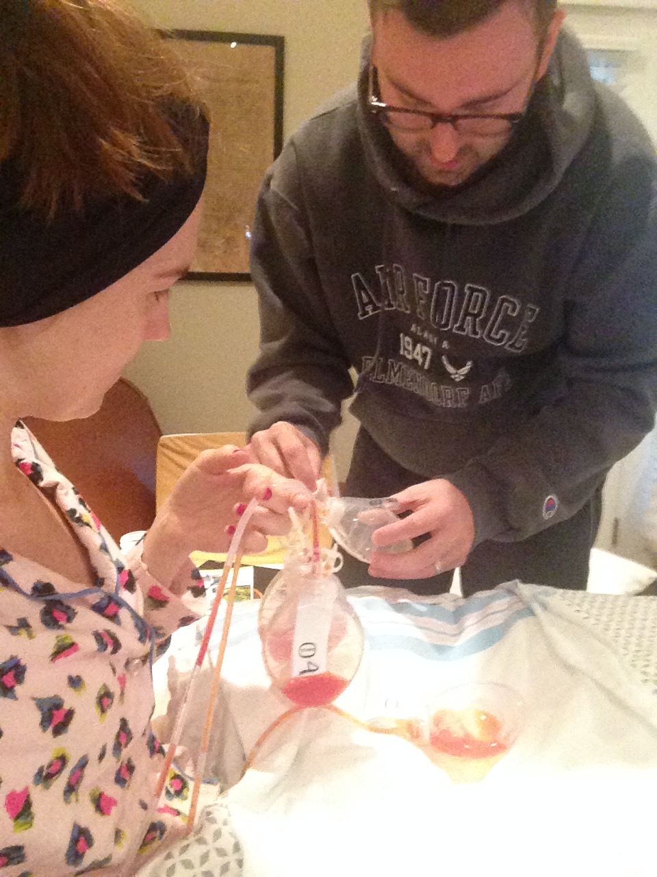 Mastectomy 101 Surgical Drains & Tissue Expanders (10 Weeks Post Op