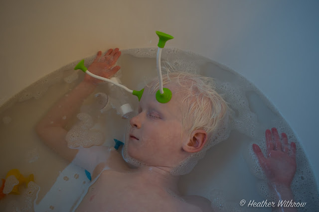 A 6 year old white-haired DeafBlind boy relaxes in the tub but also has two long 'antennae' with green suckers stuck on his forehead.