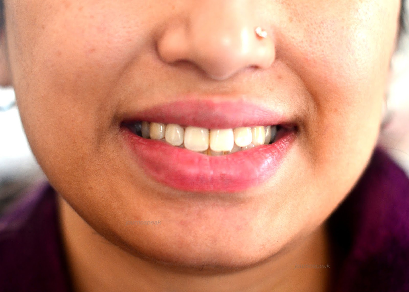 TEETH WHITENING FOR COFFEE STAINS JOURNOSPEAK