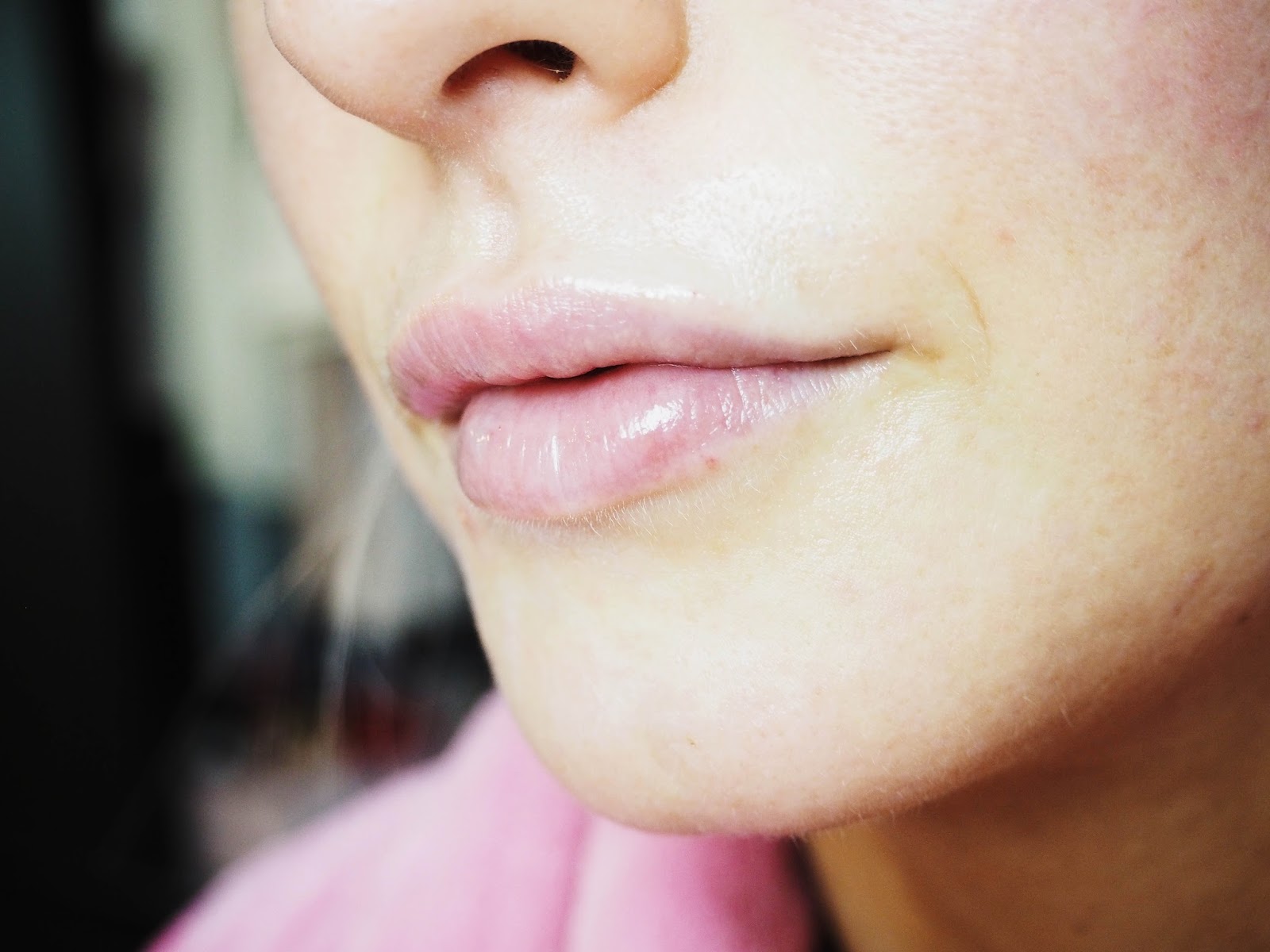 I GOT MY LIPS DONE!! GIRL TALK WITH LAURA