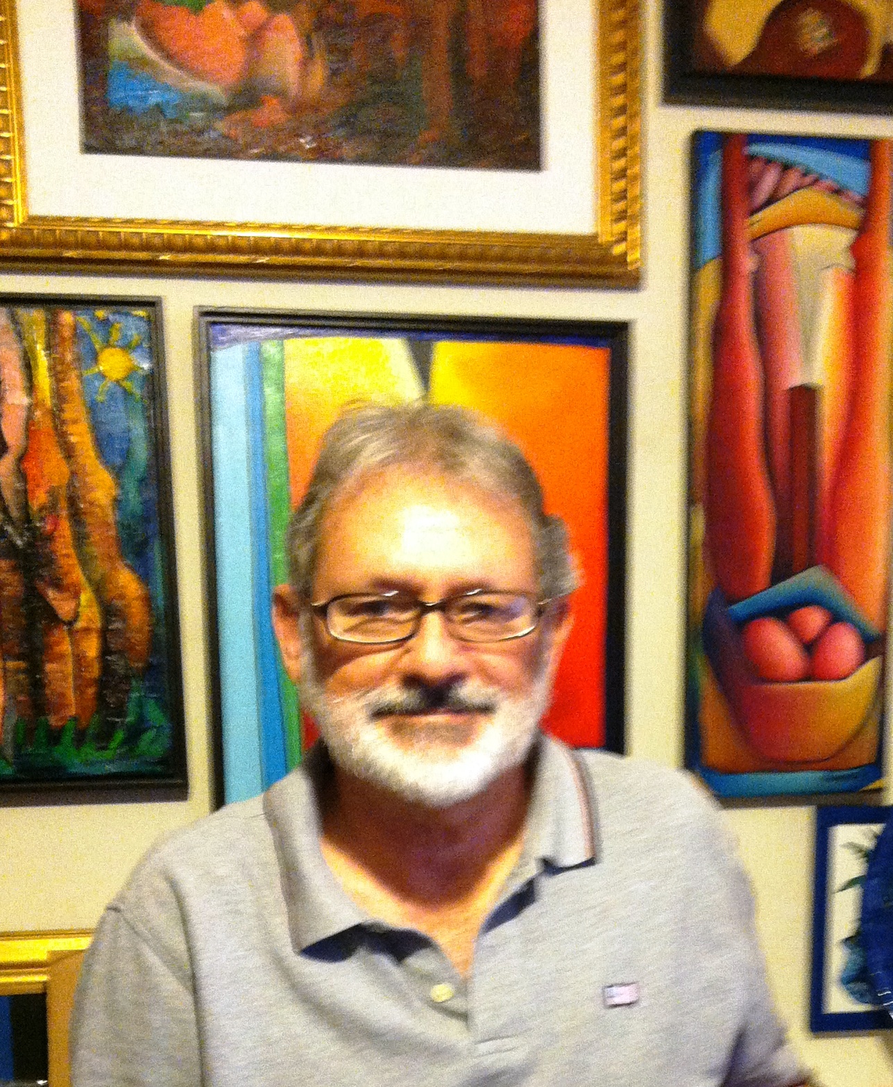 Mark Cuban Plastic Surgery: Fact Or Fiction? Expert Opinions Unveiled - 8silcbb